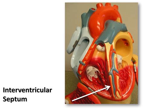 Interventricular septum - The Anatomy of the Heart Visual … | Flickr