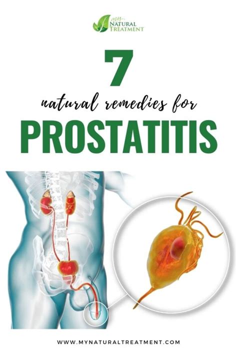 7 Natural Remedies for Prostatitis with Herbs 🌿 Prostatitis