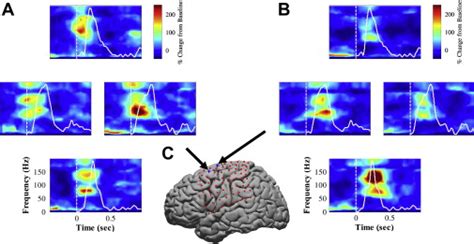 Neural Interface Technology for Rehabilitation: Exploiting and ...