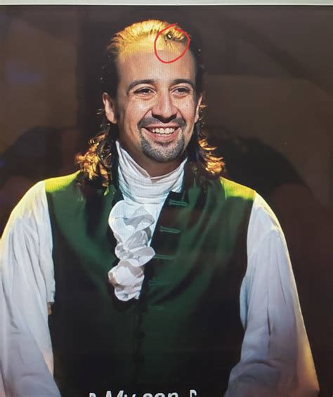 What are these two black strands sticking out of actor Lin-Manuel Miranda's hairline in Hamilton ...