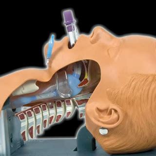 Webbingbabel: Airway Device KING LT-D , Supraglottic