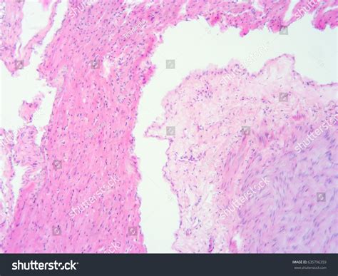 Histology Human Heart Tissue Show Cardiac Stock Photo 635796359 | Shutterstock