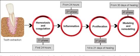 Figure 1 from Molecular and Cellular Aspects of Socket Healing in the Absence and Presence of ...