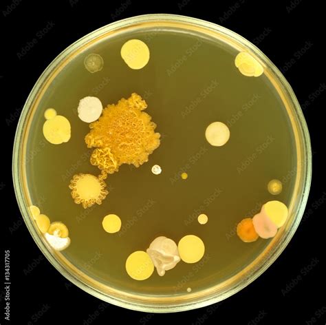 Big colorful colonies of bacteria on a petri dish (agar plate) isolated ...