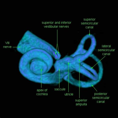 Great images of CT and 3D scans of the inner ear. There are 3D images of cochlear implants. It ...