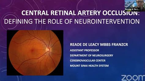 Central Retinal Artery Occlusion: Defining the Role of Neurointervention - Physician's Channel ...