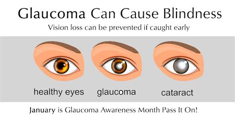 Glaucoma Awareness Month - Braillo Braille Printers and Braille Embossers