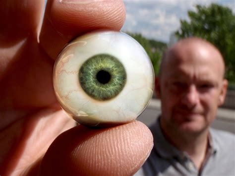 Glass Eye Prosthesis: What It Is, Benefits, and More