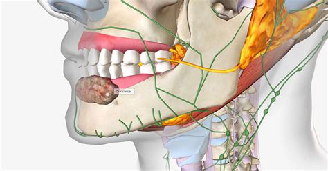 Oral Cancer Symptoms, Causes: An Oncologist Explains