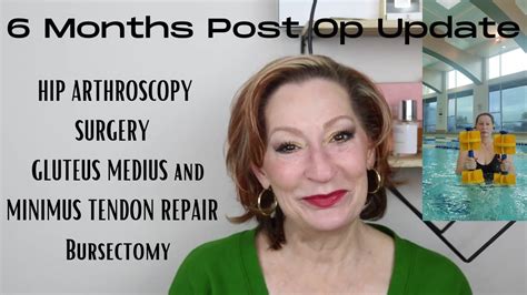 6 Months Post OP HIP ARTHROSCOPY SURGERY | GLUTEUS MEDIUS and MINIMUS TENDON REPAIR | Bursectomy ...