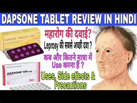 Dapsone 100mg Tablet | Dapsone Tablet Uses, Side effects & Dose | antileprotic drugs in hindi ...