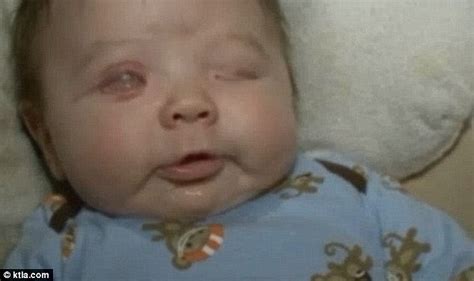 The baby girl born with no EYES: Rare condition means child will never see | Daily Mail Online