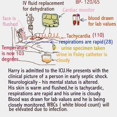 Dear Nurses: SEPTIC SHOCK CASE STUDY