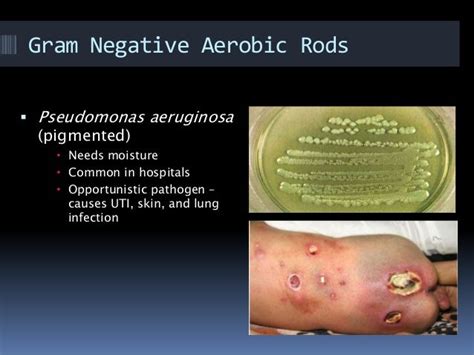 Gram positive Rods in Blood