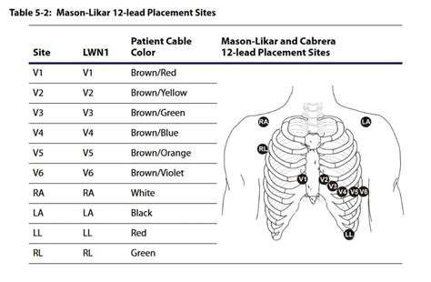 [DIAGRAM] Ecg Lead Placement Guide Diagram - MYDIAGRAM.ONLINE