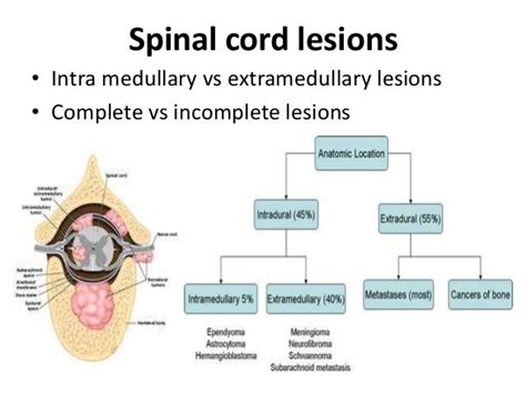 Spinal Cord Syndromes-An Overveiw