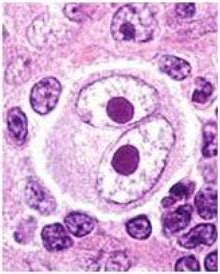 Bodies O-R - Pathological and non-pathological bodies