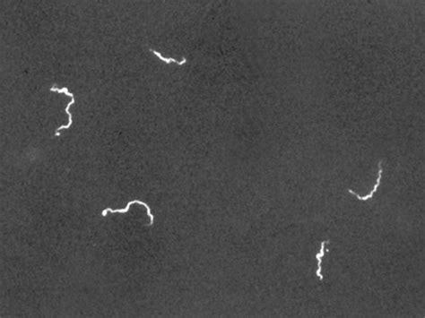 Dark-field Microscopy Is Often Used to Detect Which Bacterial Shape - FrankiegroPratt