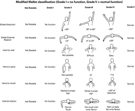 Shoulder Abduction And Flexion Exercises For Babies With Brachial ...