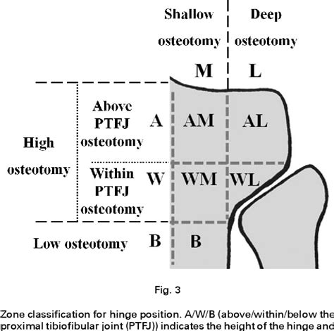 Appropriate hinge position for prevention of unstable lateral hinge ...