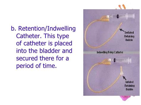 Urinary Catheterization