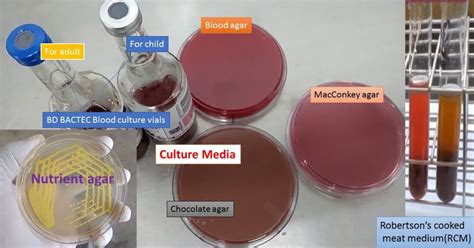 Culture media:Introduction, composition, types and their uses - universe84a