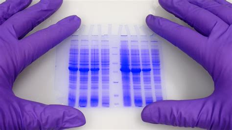 Polyacrylamide Gel Electrophoresis, How It Works, Technique Variants ...