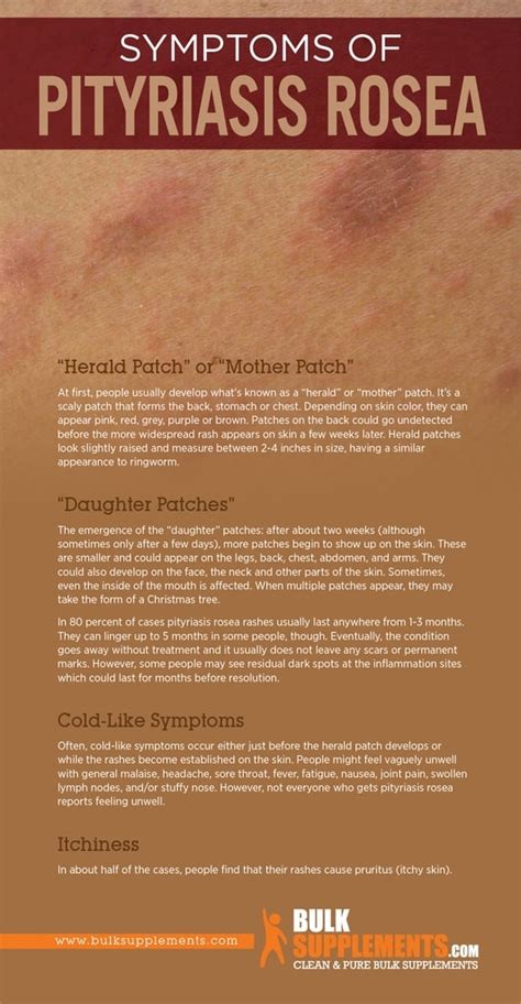 Pityriasis Rosea: Symptoms, Causes & Treatment