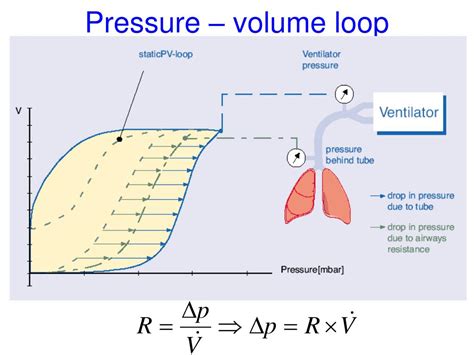 PPT - Interpretation of Ventilator Graphics PowerPoint Presentation ...