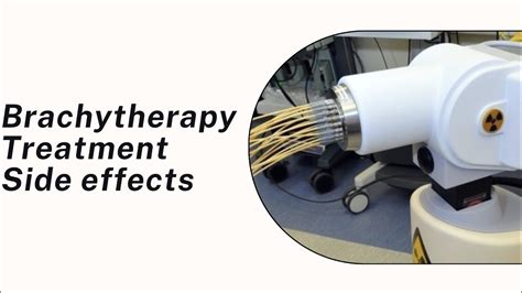 Brachytherapy side effects | Radiotherapy Edutech | Radiotherapy side ...