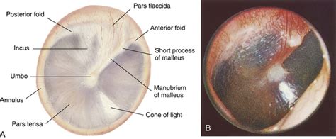 Ear, Nose, Throat, and Mouth | Musculoskeletal Key