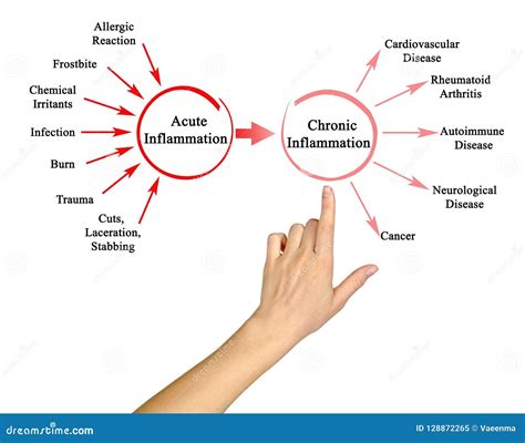 Chronic Inflammation Stock Image | CartoonDealer.com #85625629