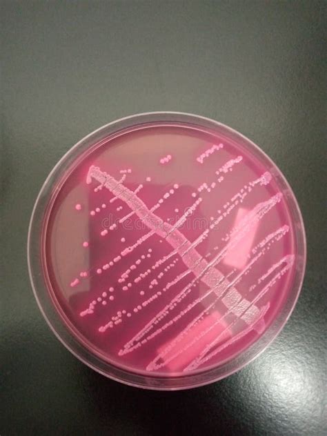 E. Coli Bacteria on Culture Medium Stock Image - Image of lighting, purple: 247310961