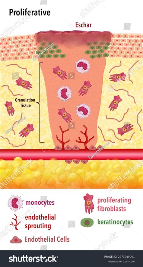 Stages Wound Healing Process Proliferative Phase Stock Illustration ...