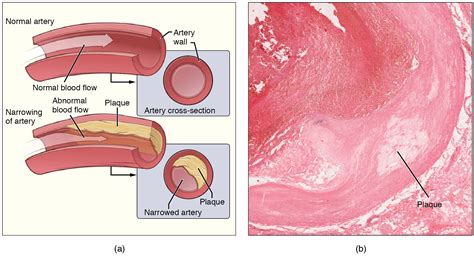 Blood Flow, Blood Pressure, and Resistance · Anatomy and Physiology