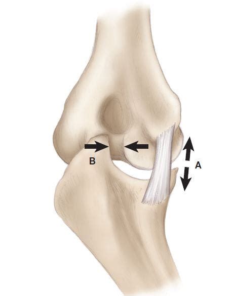 What Every Pitcher, Parent, and Coach Should Know About Loose Chips in ...