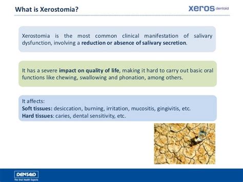 Xerostomia Causes Symptoms Treatment Xerostomia