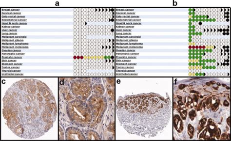 A Human Protein Atlas for Normal and Cancer Tissues Based on Antibody ...