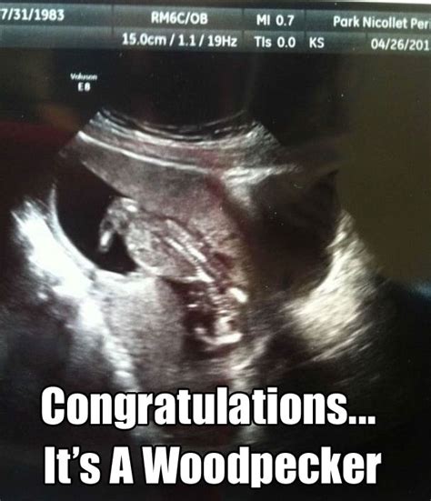 20 Of The Funniest Ultrasound Pictures…