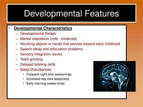 PPT - Smith Magenis Syndrome PowerPoint Presentation, free download - ID:5656784