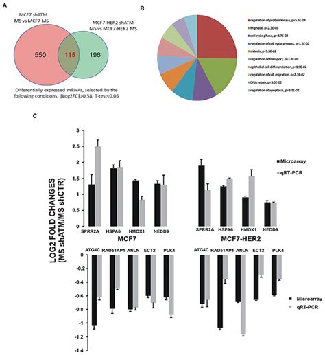 ATM kinase sustains breast cancer stem-like cells by promoting ATG4C expression and autophagy ...