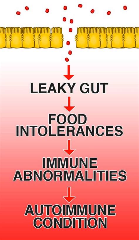 Guide To Healing Autoimmune Disease And Leaky Gut