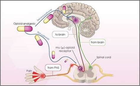 HYDROmorphone vs. Morphine - Medication Safety at the Bedside