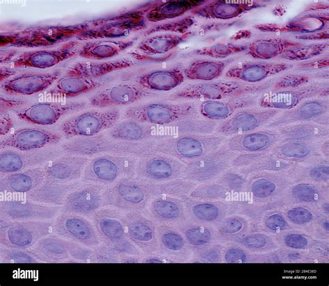 Light micrograph showing the stratum spinosum (bottom) and the stratum granulosum (granular ...