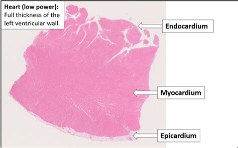 Heart – Normal Histology – NUS Pathweb :: NUS Pathweb