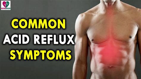 Common Acid Reflux Symptoms - Gastric Problem Symptoms - YouTube