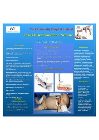 Fascia iliaca block for neonates | PDF | Free Download