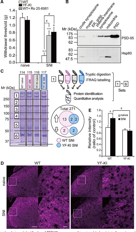 Figure 1 from Involvement of Brain-Enriched Guanylate Kinase-Associated Protein (BEGAIN) in ...