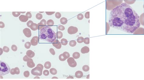 Toxic Granulation • The Blood Project