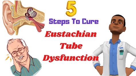 5 Steps to Cure Eustachian Tube Dysfunction LIVE | Healing at Home ...
